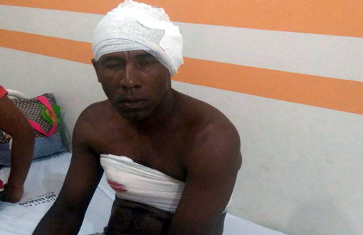 Homem é vítima de tentativa de homicídio em Malhada