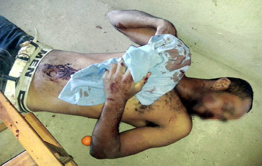 Caetité: Homem mata irmão com facada após discussão 