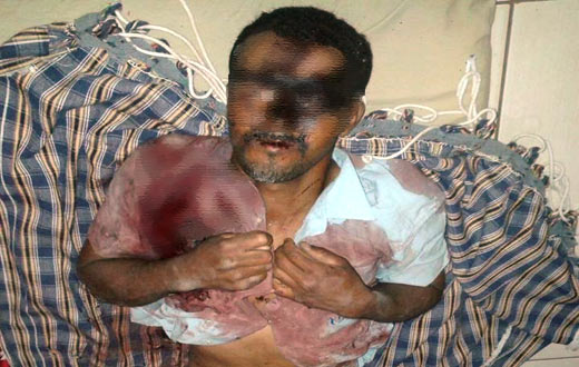 Caetité: homem morre vítima de disparo acidental em caçada